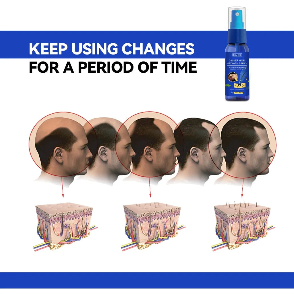 Spray Croissance des Cheveux au Gingembre – Anti-Chute et Traitement de la Perte de Cheveux pour Hommes et Femmes