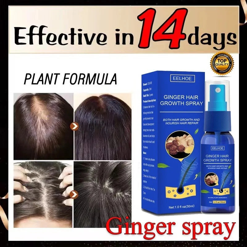 Spray Croissance des Cheveux au Gingembre – Anti-Chute et Traitement de la Perte de Cheveux pour Hommes et Femmes